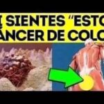 Cáncer de Colon: Causas , Síntomas y Como Prevenirlo